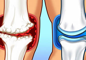 Fond de ten Pure Foundation