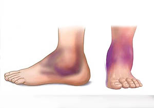 Fond de ten Pure Foundation